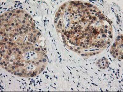 Immunohistochemistry-Paraffin: TOMM34 Antibody (OTI2A9) [NBP2-00892]