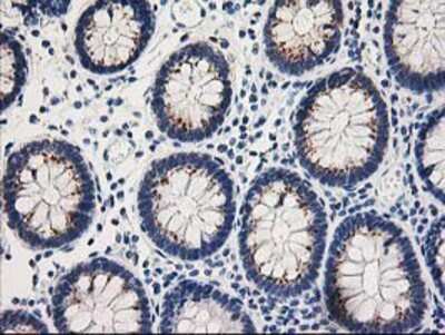Immunohistochemistry-Paraffin: TOMM34 Antibody (OTI2A9) [NBP2-00892]