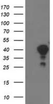 Western Blot: TOMM34 Antibody (OTI2A9) [NBP2-00892]