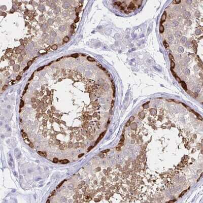 Immunohistochemistry: TOMM34 Antibody [NBP2-38810]