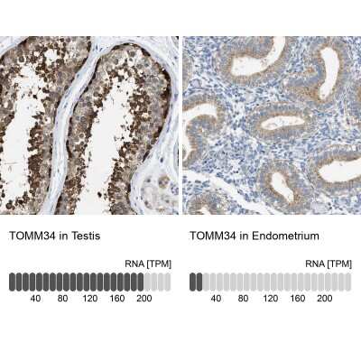 Immunohistochemistry-Paraffin: TOMM34 Antibody [NBP1-81655]