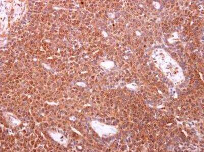 Immunohistochemistry-Paraffin: TOMM34 Antibody [NBP2-20682]