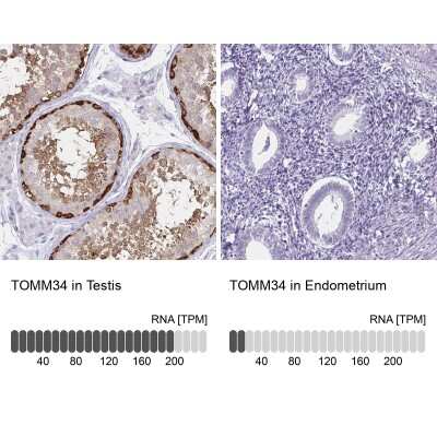Immunohistochemistry-Paraffin: TOMM34 Antibody [NBP2-38810]