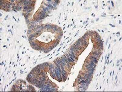 Immunohistochemistry: TOMM34 Antibody (OTI2A9) - Azide and BSA Free [NBP2-74550]