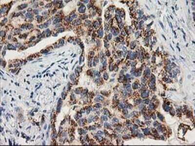 Immunohistochemistry: TOMM34 Antibody (OTI2A9) - Azide and BSA Free [NBP2-74550]
