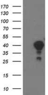 Western Blot: TOMM34 Antibody (OTI2A9)Azide and BSA Free [NBP2-74550]