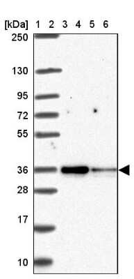 Western Blot: TOMM34 Antibody [NBP2-38810]