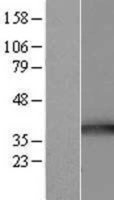 Western Blot: TOMM34 Overexpression Lysate [NBL1-17191]