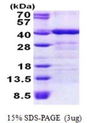 SDS-PAGE: Recombinant Human TOMM34 His Protein [NBP2-22884]