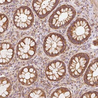 Immunohistochemistry: TOMM40 Antibody [NBP2-37879]