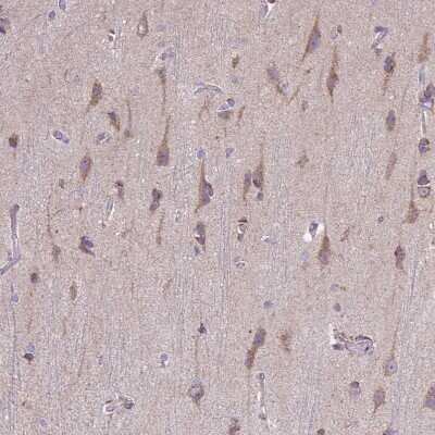 Immunohistochemistry-Paraffin: TOMM40 Antibody [NBP2-38289]