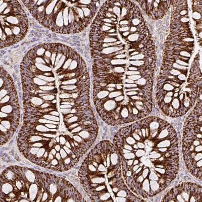 Immunohistochemistry-Paraffin: TOMM40 Antibody [NBP2-38289]