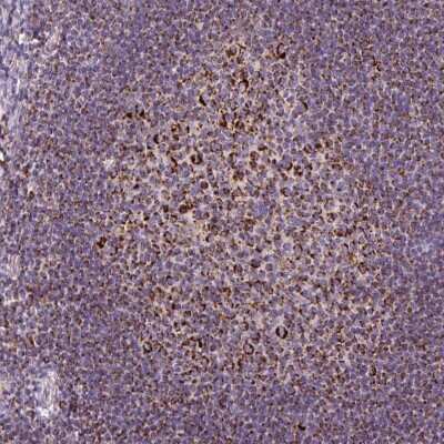 Immunohistochemistry-Paraffin: TOMM40 Antibody [NBP2-38289]