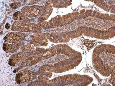 Immunohistochemistry-Paraffin: TOMM40 Antibody [NBP3-13293]