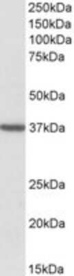 Western Blot: TOMM40 Antibody [NBP1-51997]