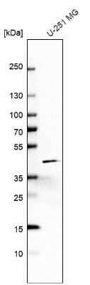 Western Blot: TOMM40 Antibody [NBP2-38289]