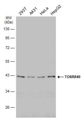 Western Blot: TOMM40 Antibody [NBP3-13290]