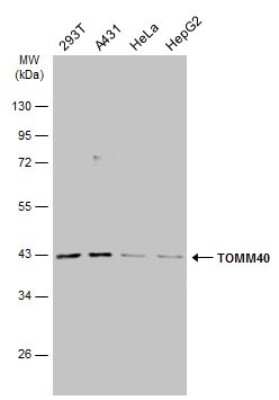 Western Blot: TOMM40 Antibody [NBP3-13293]