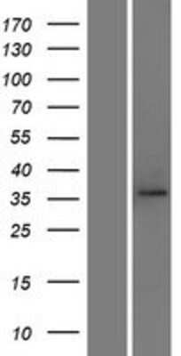 Western Blot: TOMM40 Overexpression Lysate [NBP2-07664]