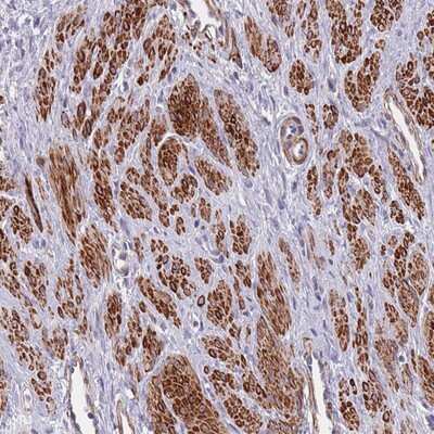 Immunohistochemistry-Paraffin: TOMM40L Antibody [NBP2-13463]