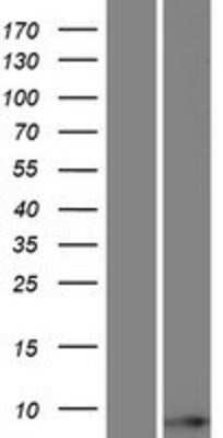 Western Blot: TOMM6 Overexpression Lysate [NBP2-09551]