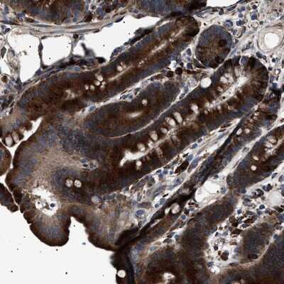 Immunohistochemistry-Paraffin: TOP1MT Antibody [NBP1-86018]