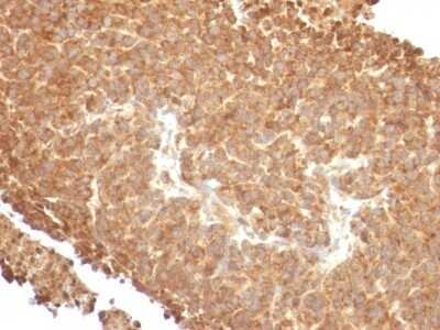 Immunohistochemistry-Paraffin: TOP1MT Antibody (TOP1MT/488) - IHC-Prediluted [NBP2-48472]
