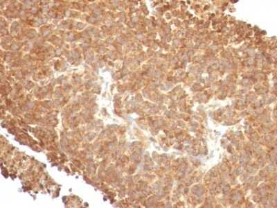 Immunohistochemistry-Paraffin: TOP1MT Antibody (TOP1MT/488) [NBP2-44360]