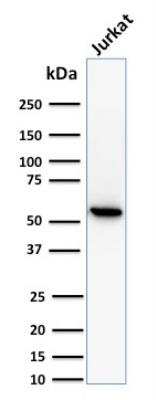 Western Blot: TOP1MT Antibody (TOP1MT/488) [NBP2-44360]