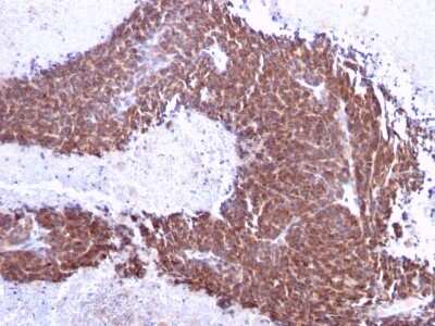 Immunohistochemistry-Paraffin: TOP1MT Antibody (TOP1MT/613) [NBP3-07562]