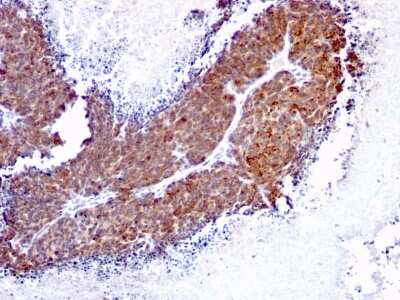 Immunohistochemistry-Paraffin: TOP1MT Antibody (TOP1MT/613) [NBP3-07562]