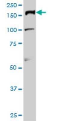 Western Blot: TOP2A Antibody (1E2) [H00007153-M01]