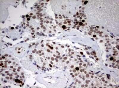 Immunohistochemistry: TOP2A Antibody (OTI2A9) [NBP2-46184]