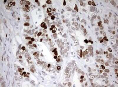 Immunohistochemistry: TOP2A Antibody (OTI2A9) [NBP2-46184]
