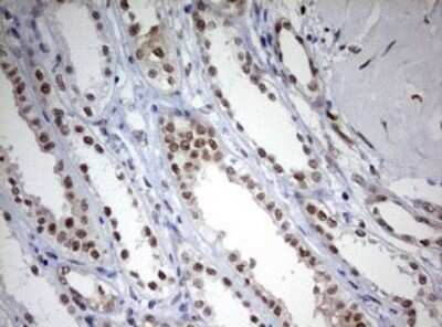 Immunohistochemistry: TOP2A Antibody (OTI2A9) [NBP2-46184]