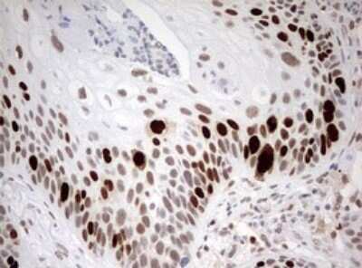 Immunohistochemistry: TOP2A Antibody (OTI2A9) [NBP2-46184]