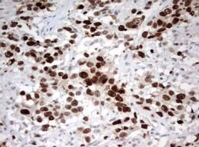 Immunohistochemistry: TOP2A Antibody (OTI2A9) [NBP2-46184]