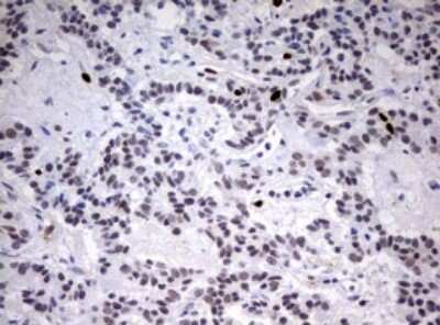 Immunohistochemistry: TOP2A Antibody (OTI2A9) [NBP2-46184]
