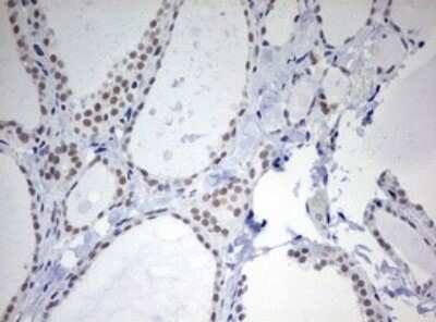 Immunohistochemistry: TOP2A Antibody (OTI2A9) [NBP2-46184]