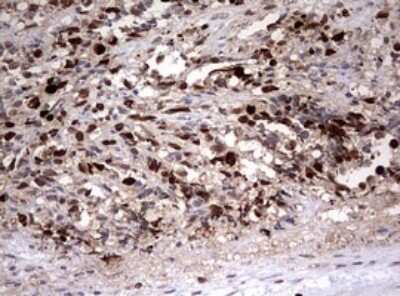 Immunohistochemistry: TOP2A Antibody (OTI2A9) [NBP2-46184]