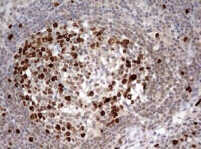 Immunohistochemistry: TOP2A Antibody (OTI2A9) [NBP2-46184]