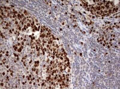 Immunohistochemistry: TOP2A Antibody (OTI2A9) [NBP2-46184]