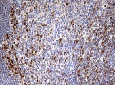 Immunohistochemistry: TOP2A Antibody (OTI2A9) [NBP2-46184]