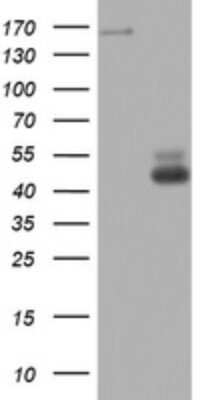 Western Blot: TOP2A Antibody (OTI2A9) [NBP2-46184]