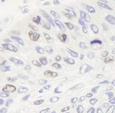 Immunohistochemistry: TOP2A Antibody [NB110-40636]