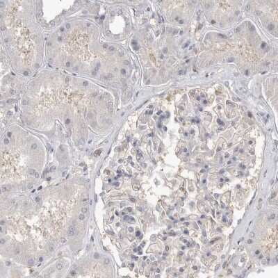Immunohistochemistry-Paraffin: TOP2A Antibody [NBP1-86927]