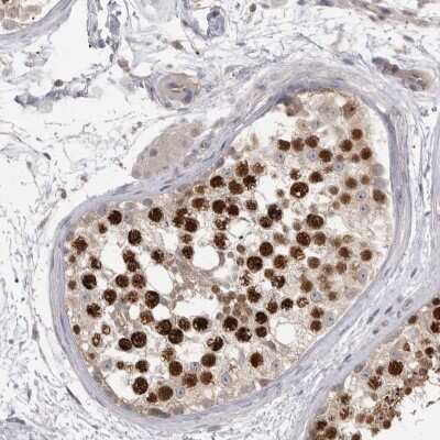 Immunohistochemistry-Paraffin: TOP2A Antibody [NBP1-86927]