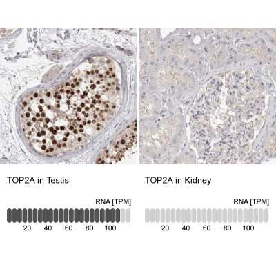 Immunohistochemistry-Paraffin: TOP2A Antibody [NBP1-86927]