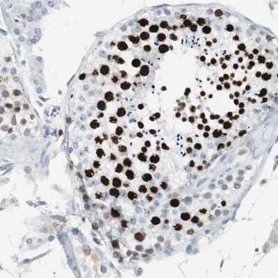 Immunohistochemistry-Paraffin: TOP2A Antibody [NBP1-86928]
