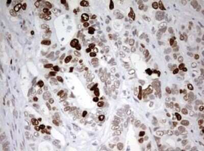 Immunohistochemistry: TOP2A Antibody (OTI2A9) - Azide and BSA Free [NBP2-74558]